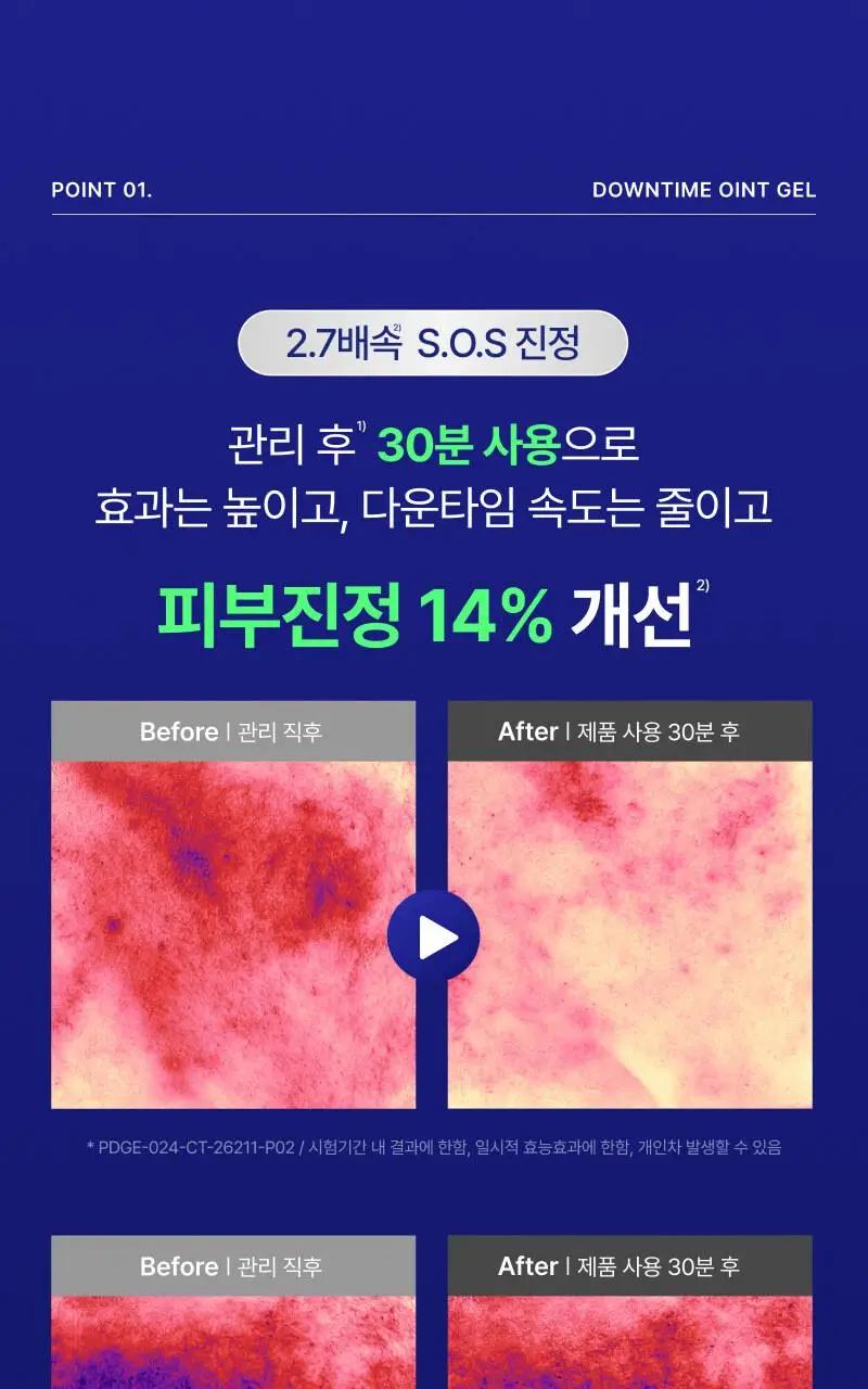 [트러블SOS진정]이지듀 EGFx 다운타임 오인트 겔 15ml 기획(+크림 7ml) 상세페이지 11